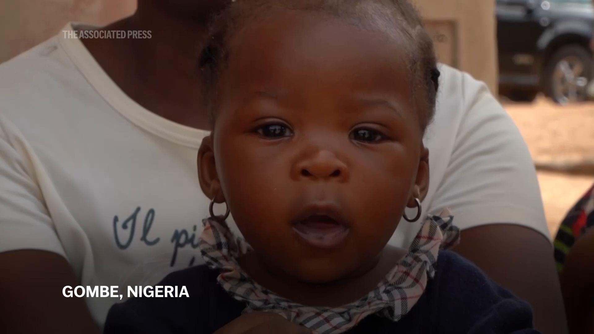 The UN Says A Quarter Of The World s Children Under 5 Have Severe Food The UN Says A Quarter Of The World s Children Under 5 Have Severe Food
